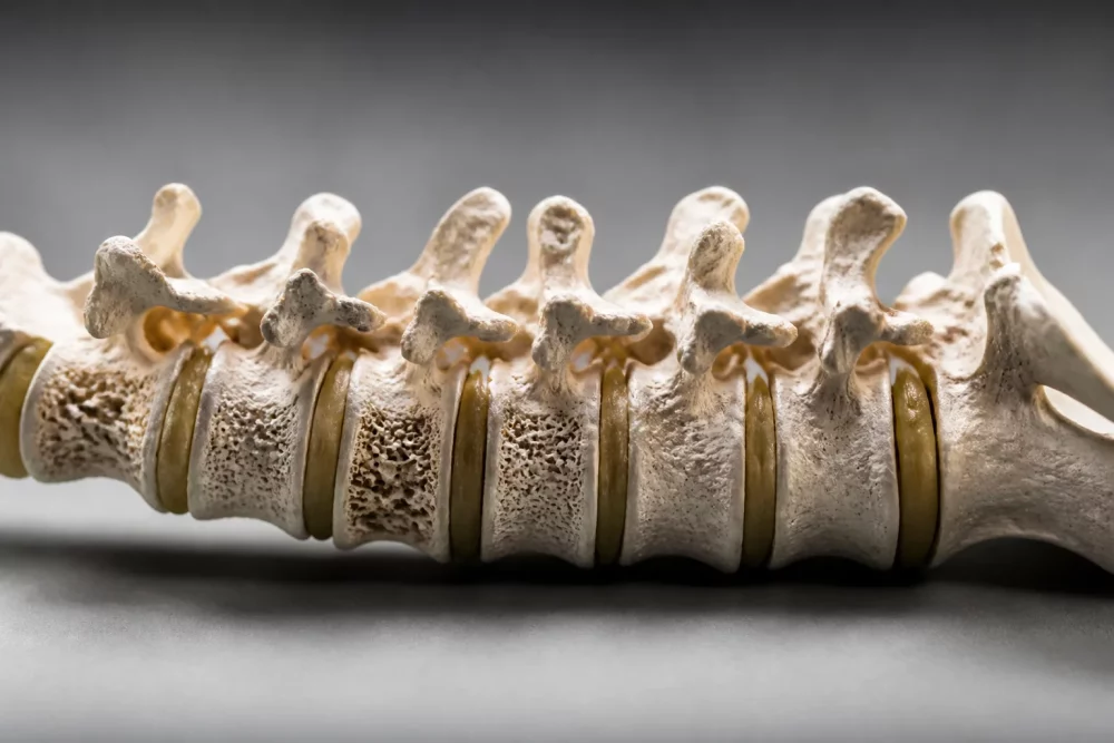 () conceptual photograph showing skeletal spine model with visible vertebrae and bone density variations, osteoporosis